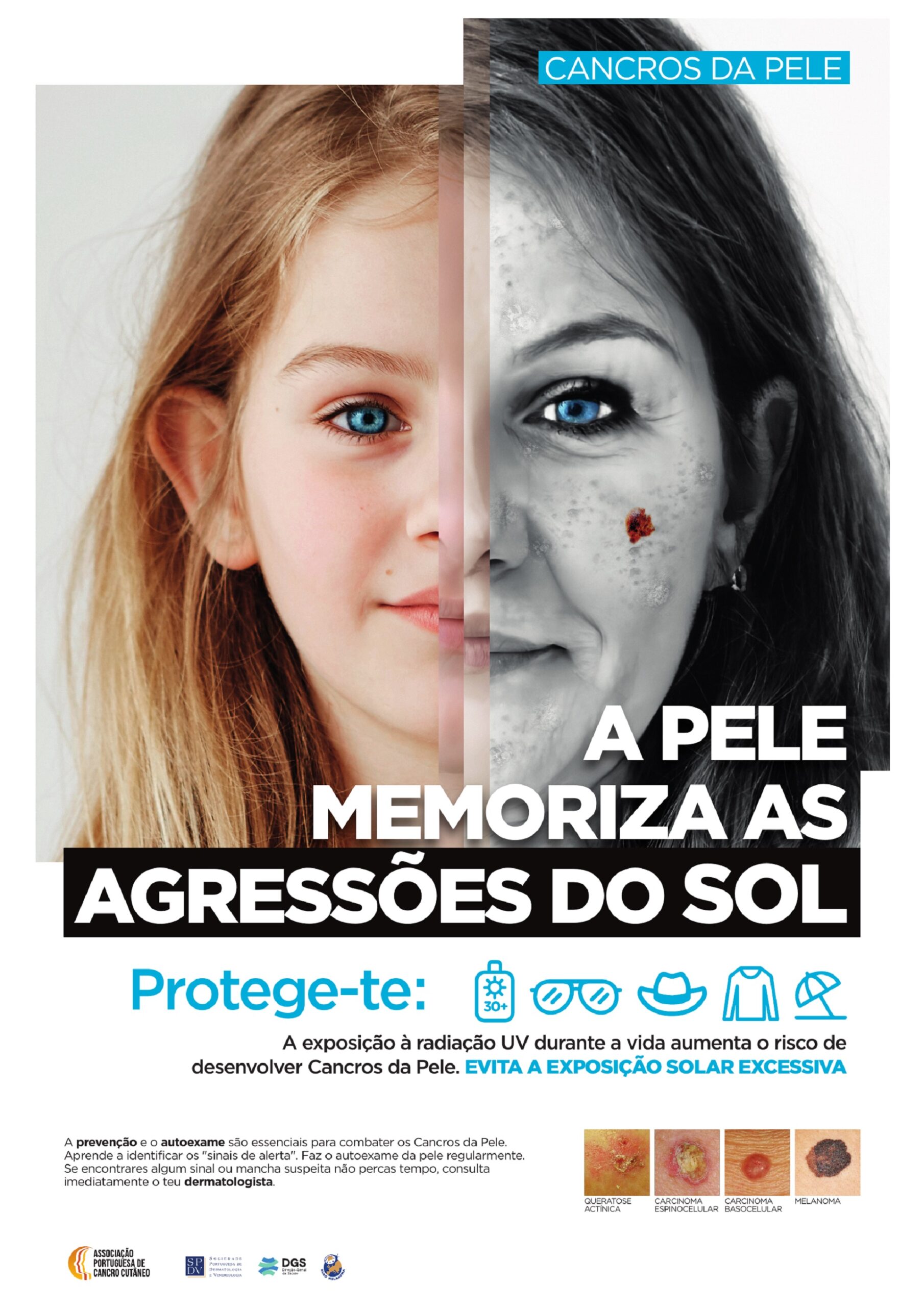 Campanha “Pele e SOL 2025” da Associação Portuguesa de Cancro Cutâneo